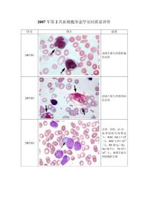 2007年第2次血细胞形态学室间质量评价