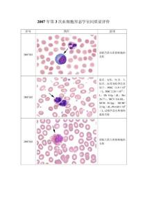 2007年第3次血细胞形态学室间质量评价