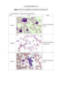 2010年第2次血细胞形态学检查室间质量评价图片