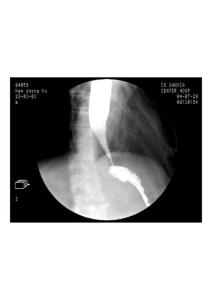 X线下的胃肠道疾病表现