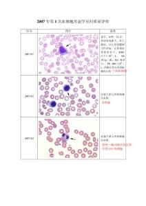 2007-2014年卫生部临检中心血细胞形态学检查室间质量评价(及答案)