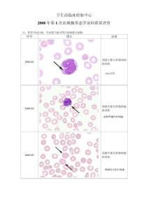 2008年第1次血细胞形态学室间质量评价
