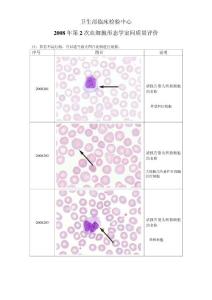 2008年第2次血细胞形态学室间质量评价