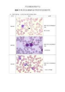 2010年第3次血细胞形态学检查室间质量评价图片（及答案）