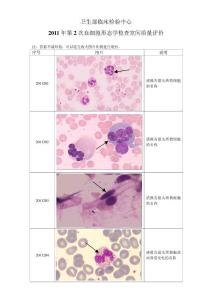 2011年第2次血细胞形态学检查室间质量评价