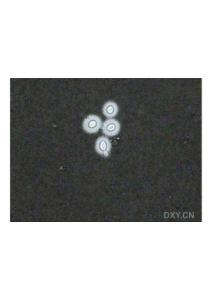 隐球菌图片
