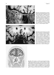脑MRI图集高清英文版 - J. C. Tamraz, Springer, 2006_部分8