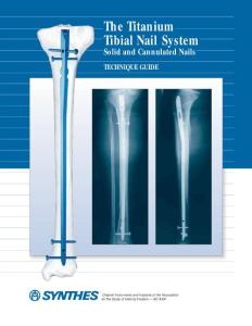 Titanium Tibial Nail System Solid and Cannulated Nails Technique Guide