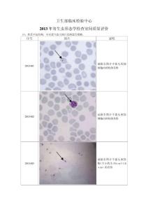 2013年寄生虫形态学检查室间质量评价