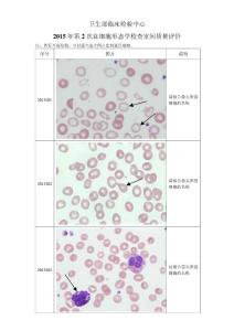 2015年第2次血细胞形态学检查室间质量评价.