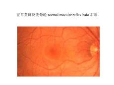正常眼底图