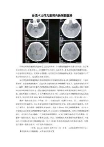 分流術治療兒童顱內蛛網膜囊腫