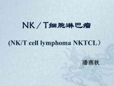 NK／T细胞淋巴瘤