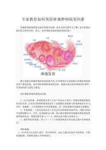 專家教你如何預防卵巢腫瘤病變因素