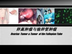 卵巢肿瘤与输卵管肿瘤 ppt课件