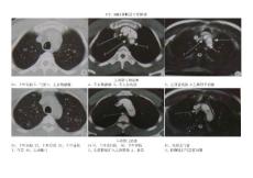 CT、MRI橫斷面正常解剖