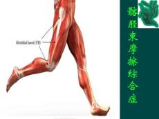 髂胫束摩擦综合症PPT