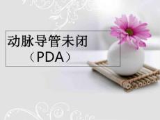 动脉导管未闭PPT课件
