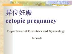 Ectopic Pregnancy中文