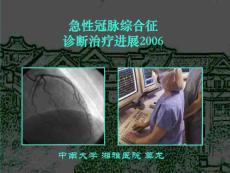 急性冠脉综合征的治疗2006102