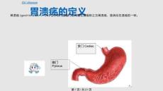胃溃疡演示文稿