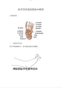 趾骨骨折康复锻炼健康图谱