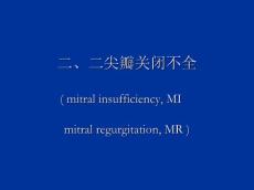 2.二尖瓣关闭不全