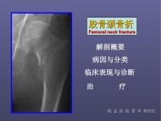 股骨颈骨折-PPT
