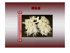 《肺栓塞病例》