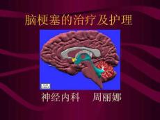 《脑梗塞护理》
