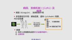 干燥综合征学习教案