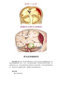 颅内血肿健康教育