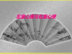 左室心梗与右室心梗