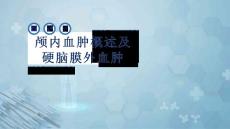 外科学：颅内血肿概述及硬脑膜外血肿