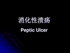 消化性溃疡
