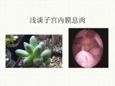 子宫内膜息肉ppt课件
