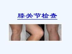 膝关节检查