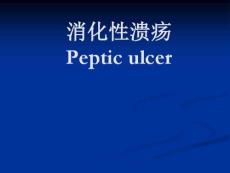_消化性溃疡