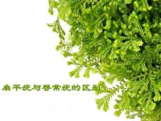 扁平疣与寻常疣的区别