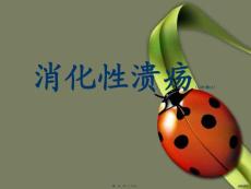 消化性溃疡