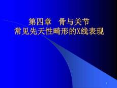 骨与关节常见先天性畸形的X线表现课件