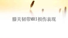 膝关韧带MRI损伤表现