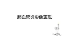 肺血管炎影像表现