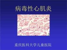 医学:病毒性心肌炎