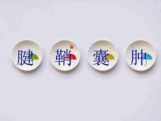 针灸治疗腱鞘囊肿
