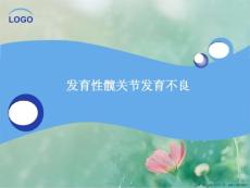 发育性髋关节发育不良