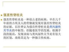 强直性脊柱炎课件