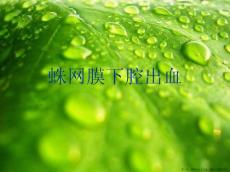 蛛网膜下腔出血