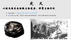 感染性心内膜炎