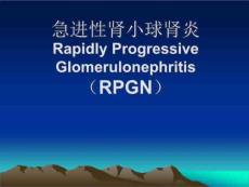 急进性肾小球肾炎